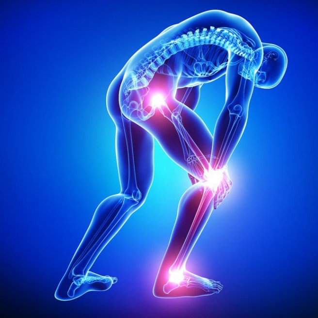 Hijama For Sciatica Nerve Pain