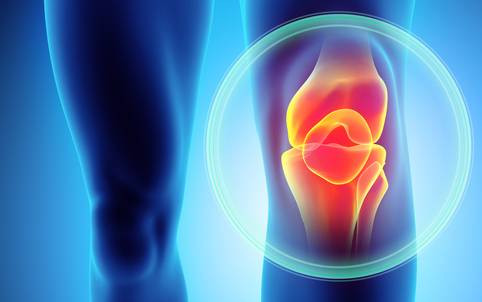 Hijama Cupping For Knee Pain