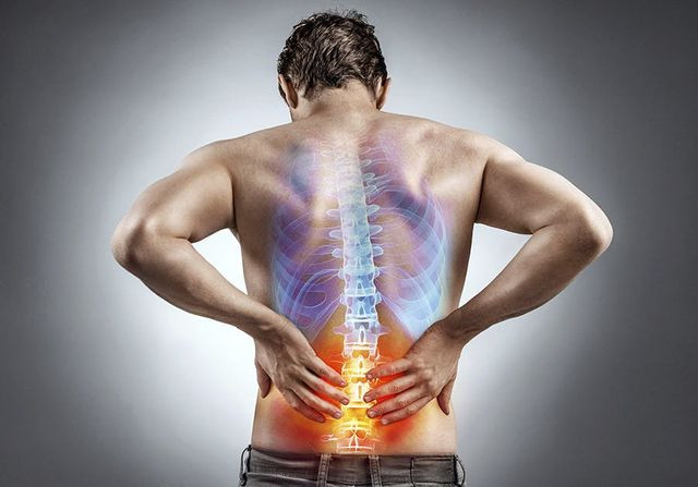 Hijama for back pain