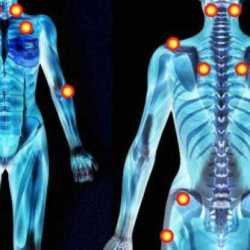 Hijama Full Body Detox