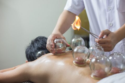 Fire cupping
